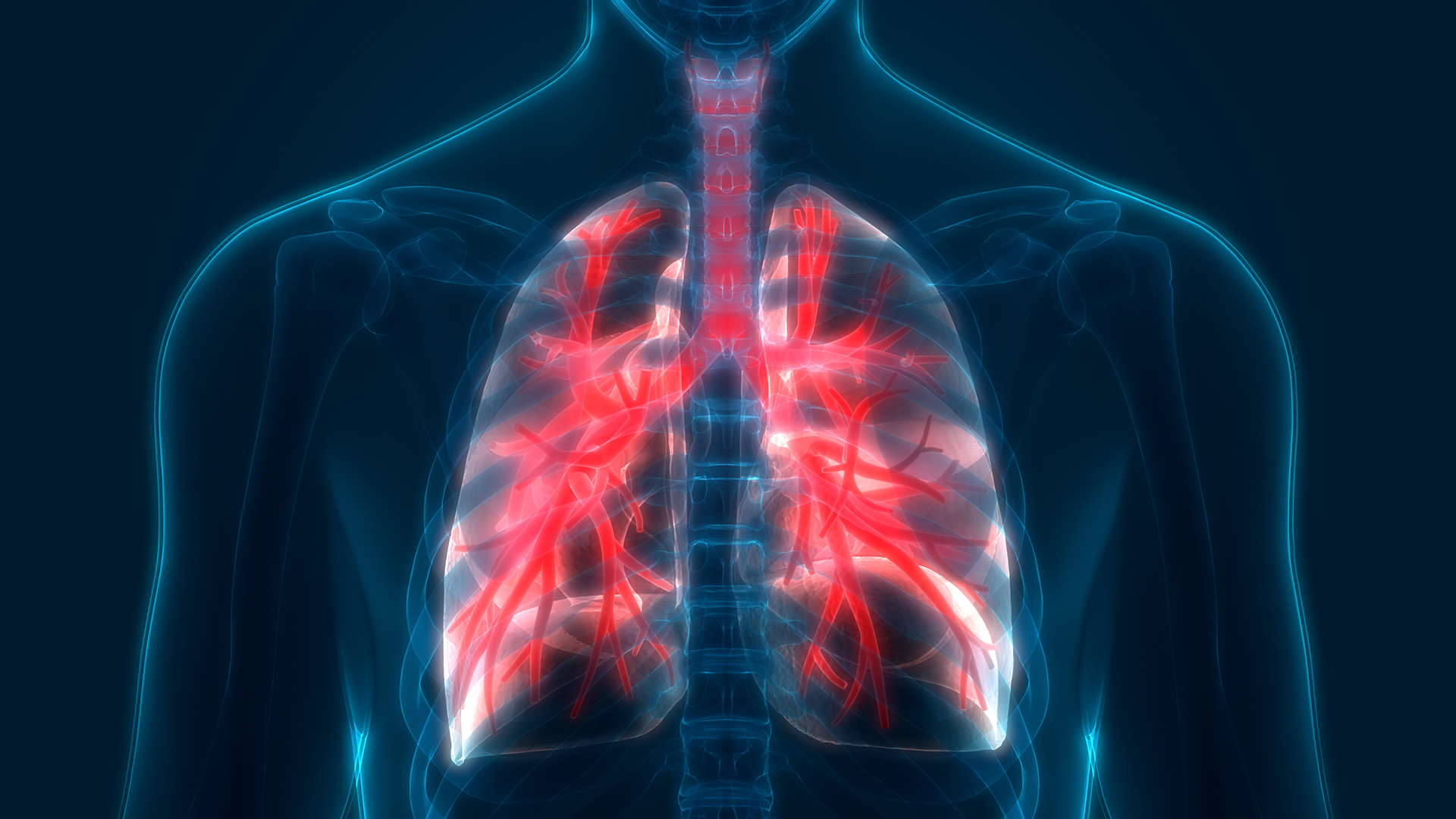 Computerized tissue-imaging may help predict early recurrence of lung