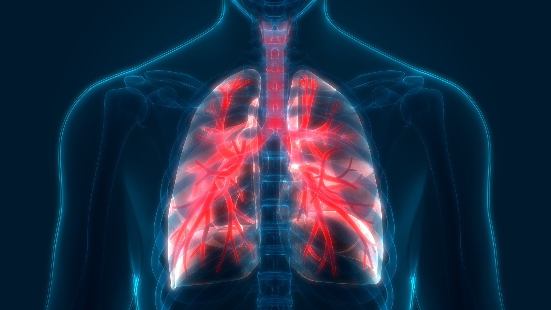 Computerized Tissue imaging May Help Predict Early Recurrence Of Lung 