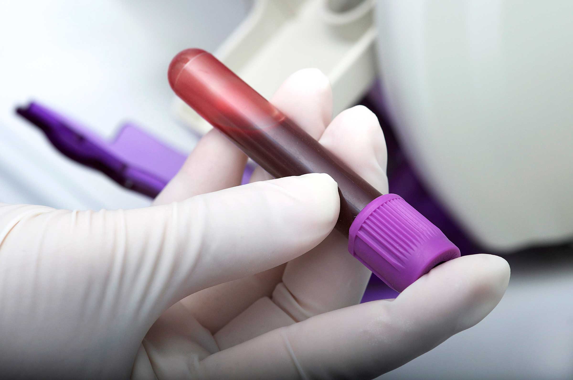 new-blood-test-to-detect-heart-attacks-faster-medtechasia