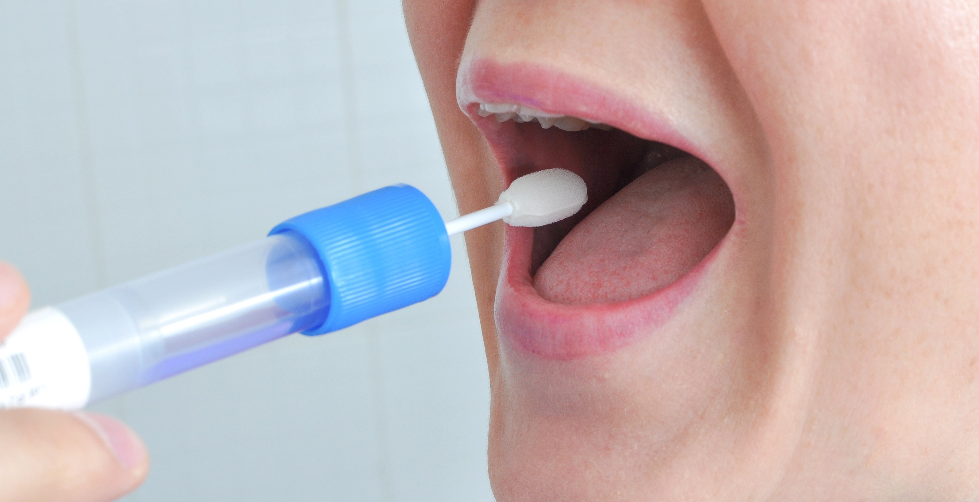 New Saliva Test For Diabetes Medtechasia