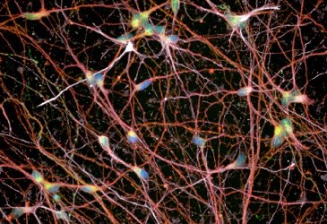 Scientists Reverse a Key Hallmark of Motor Neuron Disease in The ...