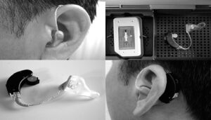 GN Hearing unveils new hearing aid technology - MedTechAsia